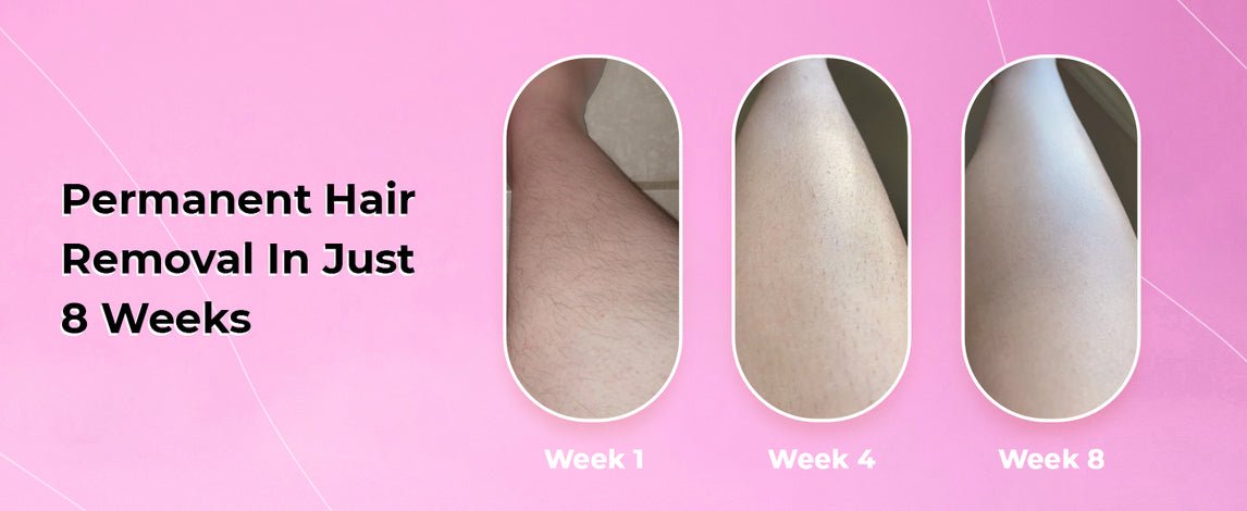 SmoothSkin Laser Hair Remover - Direct Ship Hub