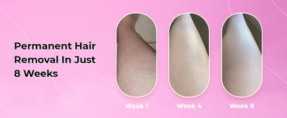 SmoothSkin Laser Hair Remover - Direct Ship Hub